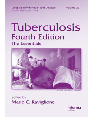 cover image of Tuberculosis